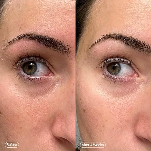 Topicals Faded Brightening Under Eye Masks | Revitalizing Patches to Depuff, Hydrate, and Illuminate | Diminishes Dark Circles and Fine Lines | Made with Kojic Acid, Caffeine & Niacinamide - 6 Count (Pack of 1) thumbnail 5