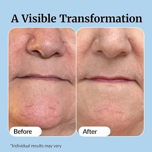 Vibriance Super C Serum for Mature Skin - All-in-One Vitamin Formula Hydrates, Firms, Lifts, Smooths, Targets Age Spots, Wrinkles, 1 fl oz thumbnail 5