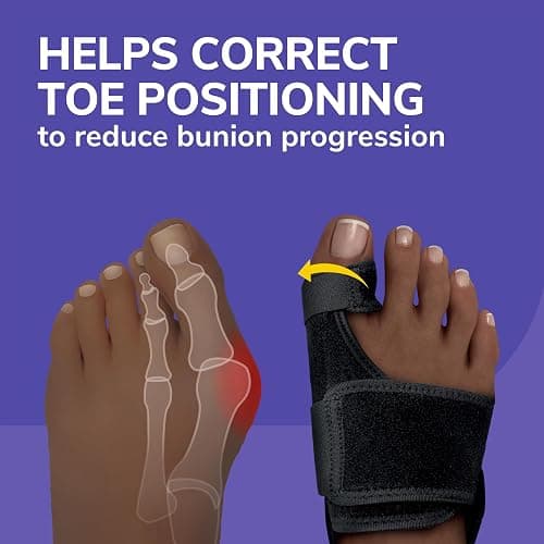 Dr. Scholl's BUNION RELIEF & TOE CORRECTOR // Massaging Gel Bunion Splint & Big Toe Straightener - Orthopedic Bunion Corrector for Women & Men - Bunion Pads for Bunion Pain Relief, 1 Support Set (Left & Right) thumbnail 2