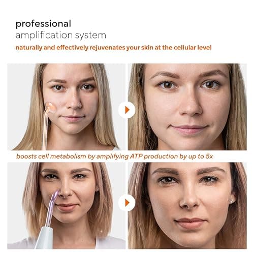 NuDerma Professional Skin Therapy Wand - Portable Skin Therapy Machine with 6 Neon & Argon Wands – Boost Your Skin – Clear Firm & Tighten thumbnail 5