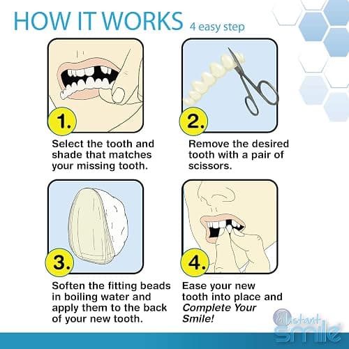 Instant Smile Complete Your Smile Temporary Tooth Replacement Kit - Replace a Missing Tooth in Minutes - Patented | Replace a Missing Tooth in Minutes, Patented thumbnail 3
