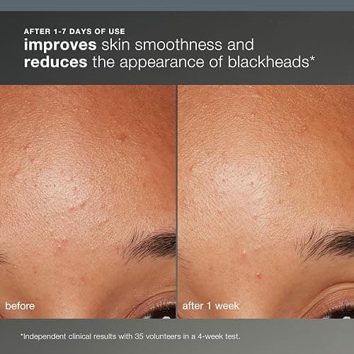 Dermalogica Daily Microfoliant, Face Exfoliator Scrub Powder with Salicylic Acid and Papaya Enzyme, Achieve Brighter, Smoother Skin Daily thumbnail 3