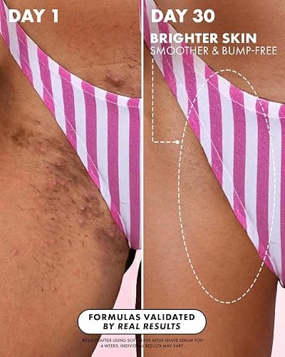 Truly Luxury After Shave Oil | Soothing & Hydrating Treatment to Prevent Ingrown Hair For Smooth, Irritation-Free Skin for Daily Use thumbnail 3