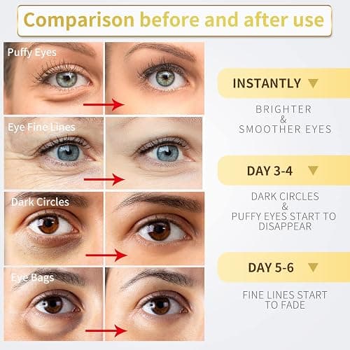 NAZANO 24K Gold Under Eye Patches - 60 Pack for Puffy Eyes, Dark Circles, Bags & Wrinkles with Collagen & Hyaluronic Acid - Eye Care Pads for Daily Skincare (Gold) thumbnail 4