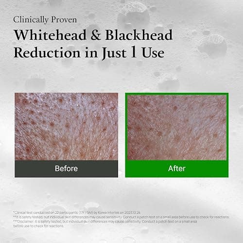 FULLY Green Tomato Pore Detox Clay Mask Cleanser, Pore Minimizing, Blackhead Care, Sebum Control, Exfoliation, Vegan, Face Wash, Sensitive Skin, Korean Skincare 4.05 fl.oz thumbnail 4