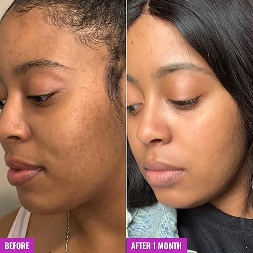 Good Molecules Glycolic Exfoliating Toner - Hyaluronic and Glycolic Acid Daily Toner for Face - Cleansing Facial Exfoliant for Glowing Even Skin Tone, Skin Care thumbnail 5