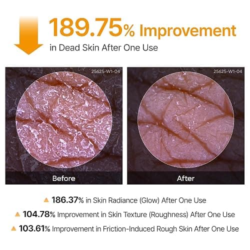 Dr.Melaxin Body Keratin Care Kojic Acid Turmeric Spray Gently Exfoliating Peeling Solution Korean Skincare All Skin Types 200ml thumbnail 6