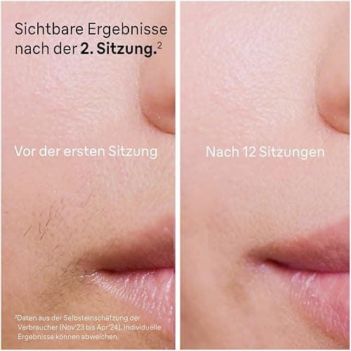Braun IPL Silk·expert Pro 5 – IPL Geräte Haarentfernung, dauerhaft und schmerzfrei Haarentfernung für Zuhause – Etui mit Gillette Venus Rasierer, 2 Aufsätze, Designed In Germany – PL5156, Weiß/Gold thumbnail 5