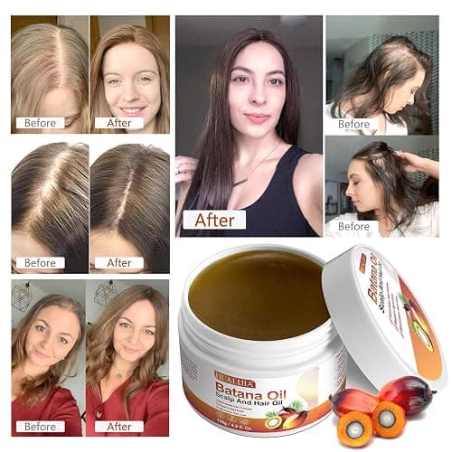 Olio di Batana Capelli, Olio di Batana, 100% Pure and Natural Batana Oil for Hair Growth-Stimola la Crescita dei Capelli, Ripara i Capelli Danneggiati, 120g thumbnail 5