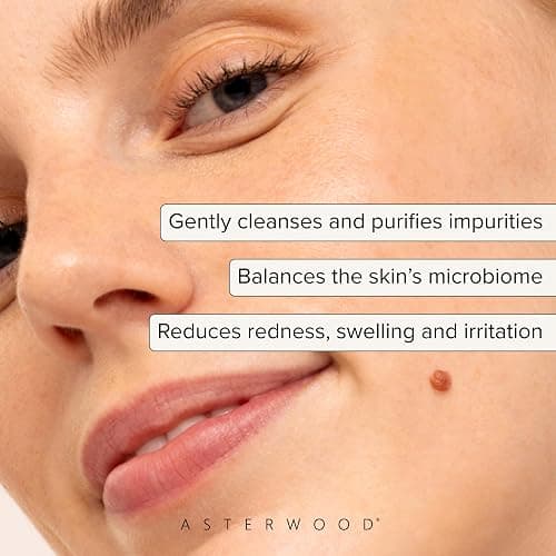 Asterwood Hypochlorous Acid Spray for Face - Targets Acne, Redness, Irritation - Multi-Purpose Skin Repair - Antibacterial, Antimicrobial - After Gym/Post-Workout Facial Mist - 4 Fl Oz thumbnail 2