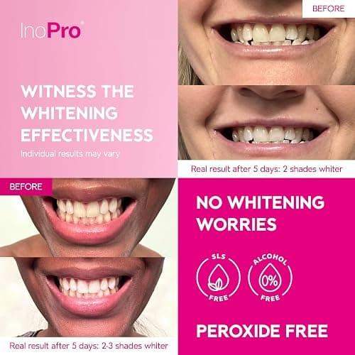 InoPro Teeth Whitening Strips 14 Treatments Kit - Enamel Safe Teeth Whitener, Peroxide-Free, Green White Strips for Teeth Whitening with Arbutin, Coconut Oil, Deep Stains Removal (28 Strips) thumbnail 3