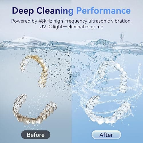 Ultrasonic Retainer Cleaner Machine 48kHz, Dental Ultrasonic Care Cleaner | Ultrasonic Retainer Cleaner for Dentures, Aligners, Mouth Guards, Toothbrush Heads and Jewelry with 200ML Capacity thumbnail 5