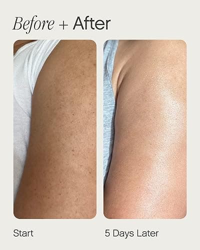 Topicals Slather Exfoliating Body Serum - With Retinol, Squalane, Urea and AHAs for Bumpy, Rough or Textured Skin - AHA Exfoliating Serum for Body (5 Fl Oz) thumbnail 4