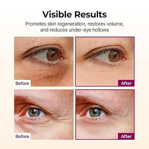 Dr.Melaxin Collagen Multi Balm Stick, Calcium & Adenosine Korean Wrinkle Stick for Eye, Neck & Face, Firming Collagen Stick, Under Eye Balm for Dark Circles & Depuffing, Korean Skin Care, 0.31 oz thumbnail 4
