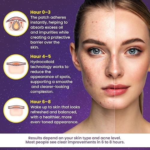 280Pcs Star Pimple Patches for Face - Pimple Patches Cute Stars - Hydrocolloid, Salicylic Acid, Tea Tree Oil, Centella - Glitter, Regular, Glow in the Dark, Translucent 7 Colors, 3 Sizes Zit Stickers thumbnail 7