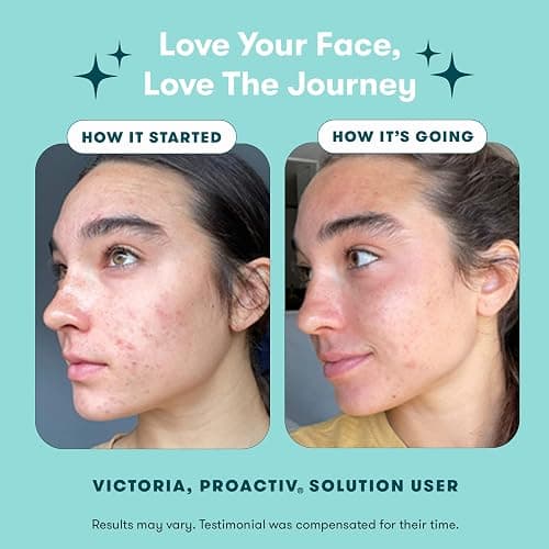 Proactiv 3 Step Acne Treatment - Benzoyl Peroxide Face Wash, Repairing Acne Spot Treatment for Face and Body, Exfoliating Toner - 30 Day Complete Acne Skin Care Kit thumbnail 3