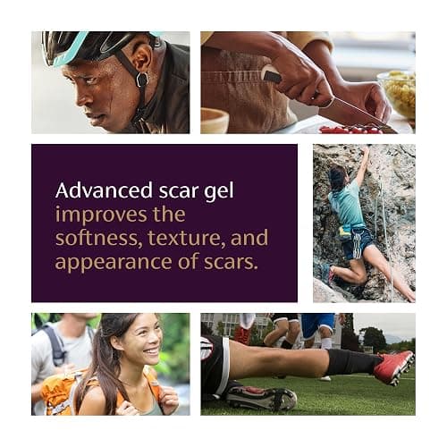 Mederma Advanced Scar Gel - Treats Old & New Scars, Reduces Appearance of Scars from Acne, Surgery, Burns, Injury & Stretch Marks, 0.70 Oz (20g) thumbnail 4