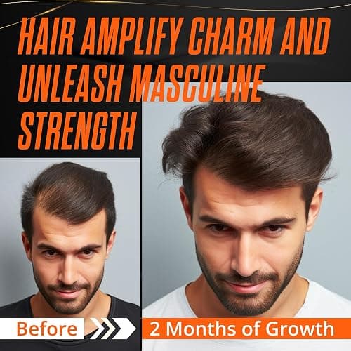 Abera Hair Growth Serum 1.69 fl oz for Hair Loss, Natural Hair Regrowth Treatment for Hair & Beard with Biotin & Castor Oil | Extra Strength & Bigger Size thumbnail 5