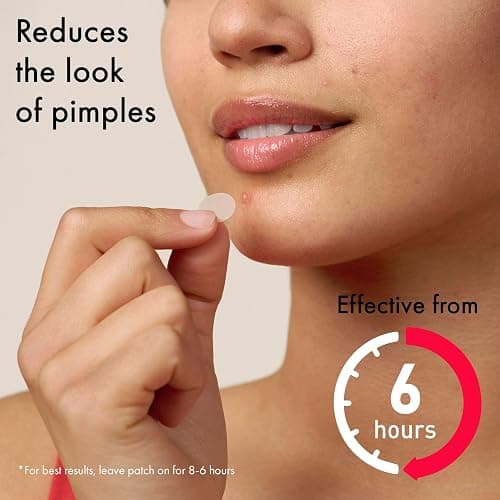Mighty Patch Original Spot Patches by Hero Cosmetics, Day & Night Time Acne Treatment, Clear Spot Remover Hydrocolloid Patches, Anti Acne Dots, Spot Treatment Pimple Stickers - 72 Pimple Patches thumbnail 2