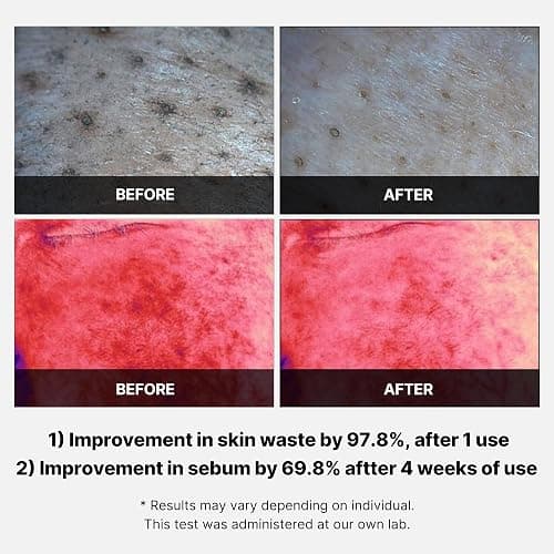medicube Swipe & Spray Red duo for Troubled Skin: Red Succinic Acid Panthenol Facial Peeling Pads and Power Soothing Spray thumbnail 4