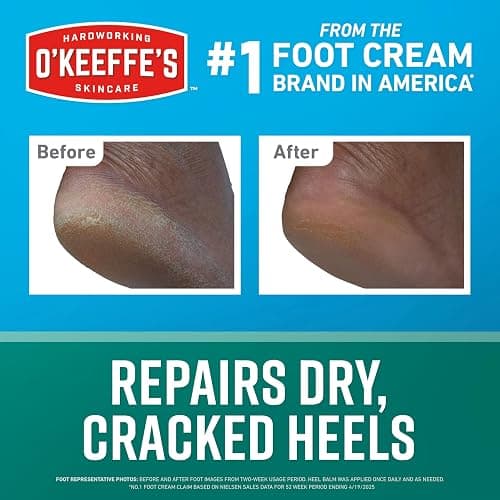 O'Keeffe's for Healthy Feet Intensive Healing Balm; Guaranteed Relief for Extremely Dry; Cracked Feet; Heel Balm that Instantly Fills Dry; Cracked Heels; 2.2oz Stick; (Pack of 1) thumbnail 4