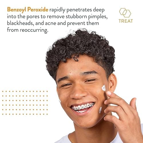 AcneFree Terminator 10 Acne Spot Treatment with Benzoyl Peroxide 10% Maximum Strength Acne Cream Treatment, 1 Ounce - Pack Of 1 thumbnail 4