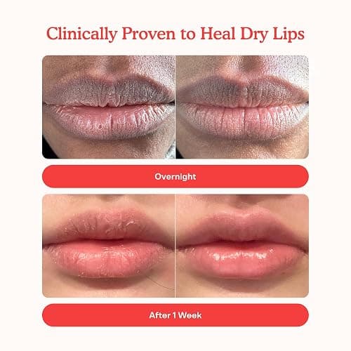 Tower 28 LipSoftie Tinted Lip Balm Treatment - Hydrating Glossy Balm + Overnight Lip Mask with Jojoba Oil + Shea Butter - Sweet, Cushiony Formula for Smooth, Soft Lips - Watermelon Kiwi (0.38 oz) thumbnail 3