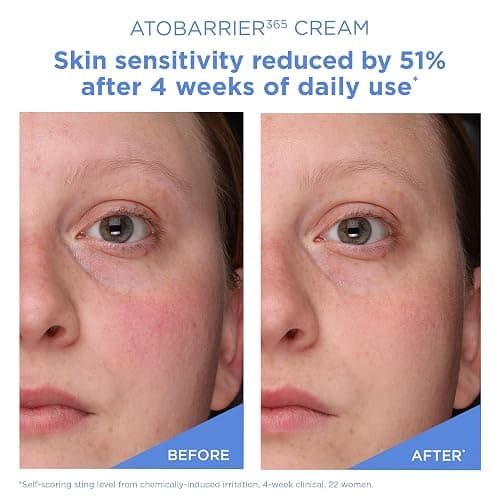 AESTURA I Cream with Ceramides, Korean Face Moisturizer for Barrier Repair | 120H lasting Hydration, Ceramide Capsules, Dry & Sensitive Skin, Non-comedogenic, 80 mL / 2.70 fl.oz. thumbnail 7