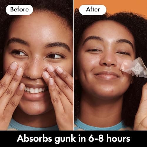 Hero Cosmetics Mighty Patch Nose, XL Hydrocolloid Spot Patches for Overnight Use, Absorb Gunk in 6 to 8 Hours, 10 Patches thumbnail 3