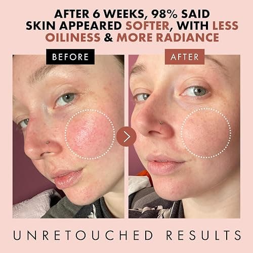 Eclat Skincare Rose Water Toner – Hydrating Toner for Face - Rosewater with Hyaluronic Acid & Aloe Vera - Alcohol Free & Skin Soothing Formula - Rejuvenating & Calming Facial Skin Care thumbnail 3