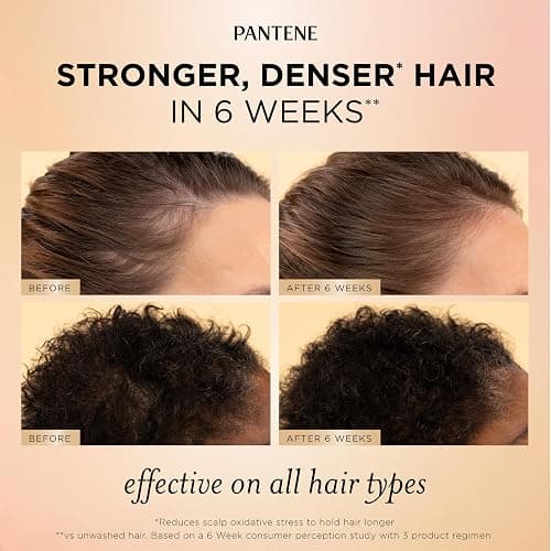 Pantene Abundant & Strong Daily Scalp Serum, Strengthens Scalp’s Hold on Roots, 2 oz thumbnail 4
