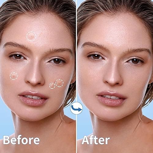 Daolyo Pimple Patches for Face, 4 Size 300 Counts Acne Patches, Hydrocolloid Patches for Covering Zits and Blemishes, Spot Stickers with Salicylic Acid, Tea Tree Oil & Calendula Oil - 300 Count (Pack of 1) thumbnail 5