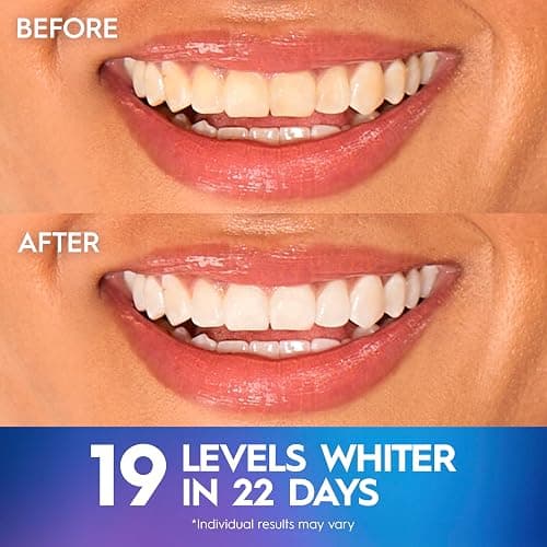 Crest Teeth Whitening Strips, Crest 3D Whitestrips Professional Effects, Enamel Safe Teeth Whitening Kit, 22 Treatments (44 Strips), Professional-Level Whitening, 19 Levels Whiter thumbnail 4