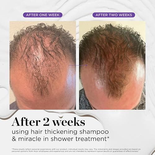 Dr. Groot Miracle in Shower Treatment, Korean Hair Care, 5 Seconds to Smooth Hair, Rosemary Oil for Healthier-Looking Hair, Hair Rinse, Moisturizing Hair Treatment, Kbeauty Scalp Revitalizing Solution thumbnail 8