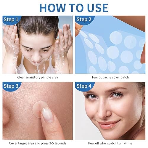 Daolyo Pimple Patches for Face, 4 Size 300 Counts Acne Patches, Hydrocolloid Patches for Covering Zits and Blemishes, Spot Stickers with Salicylic Acid, Tea Tree Oil & Calendula Oil - 300 Count (Pack of 1) thumbnail 8