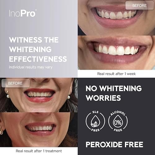 InoPro Natural Teeth Whitening Strips Kit 14 Treatments - Sensitive Teeth Whitener, Peroxide Free, Enamel Safe White Strips - Instant Teeth Whitening Without The Harm (28 Strips) thumbnail 2
