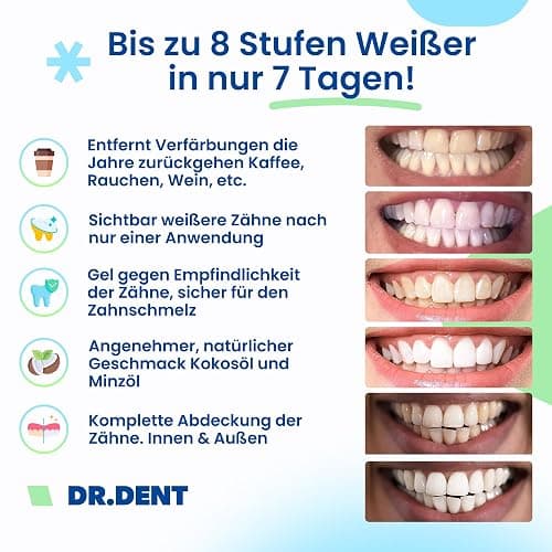 DRDENT Professional Zahnaufhellungsstreifen 21 Anwendungen - Zahnschmelz-sicher - Ohne Schmerzempfindlichkeit - Professionelle Zahnbleaching Strips - 42 Streifen + Mundöffner Inklusive thumbnail 5