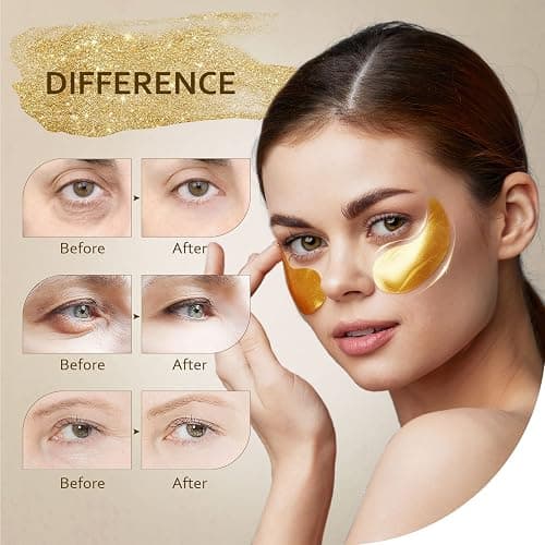 Taimand Under Eye Patches (30 Pairs), 24K Gold Under Eye Mask for Puffy Eyes, Dark Circles,Bags and Wrinkles with Collagen,Relieves Pressure and Reduces Wrinkles,Revitalises and Refreshes Your Skin thumbnail 2