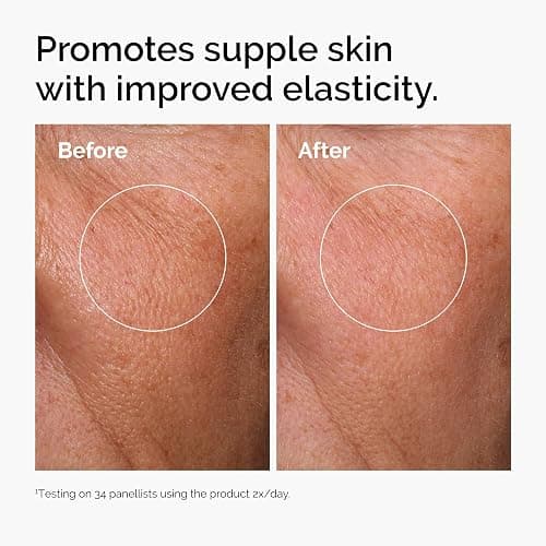 The Ordinary Hyaluronic Acid 2% + B5 (with Ceramides), Multi-Depth Hydration Serum for Plumper, Smoother Skin thumbnail 3