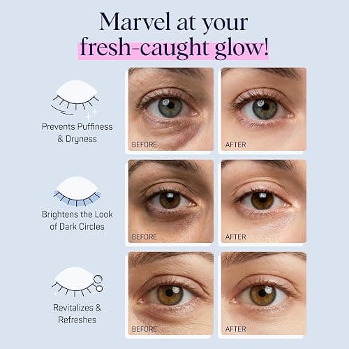 SpaLife Fresh Catch Hydrogel Under Eye Patches for Dark Circles | Sardine Under Eye Patches for Puffy Eyes | Niacinamide & Hyaluronic Acid Undereye Masks | Pack of 8 Pairs (8 Undereye Treatments). thumbnail 5