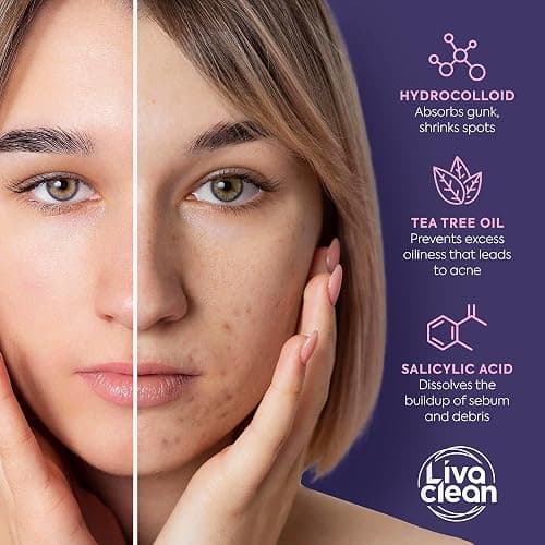 Livaclean Star Pimple Patches for Face w/ Hydrocolloid, Tea Tree oil & Salicylic Acid - Zit Stickers, Hydrocolloid Acne Patches for Face - Cute Pimple Patch, Acne Stickers thumbnail 6