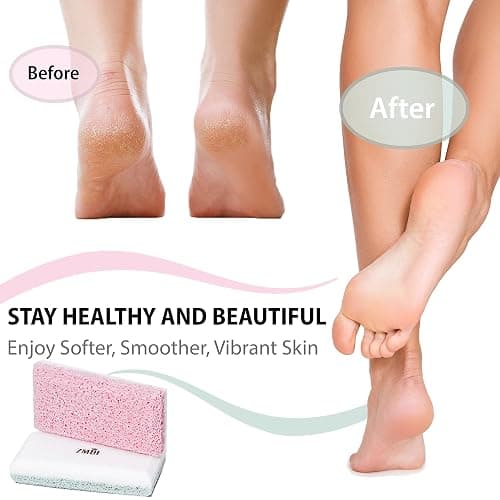 ZMOI Siliglass Pumice Stone Callus Remover for Feet, Elbows, Hands, and Knees, Spain Made - 2 in 1 Pedicure Exfoliator and Scrubber for Rough, Hard Skin (1 Pack) thumbnail 5