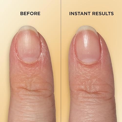 Sally Hansen Vitamin E Nail & Cuticle Treatment Pen | Hydrates and Conditions Dry Nails | Nourishing Formula with Apricot Oil | Smooth, Healthy-Looking Nails | Easy, Mess-Free Nail Care on the Go thumbnail 5