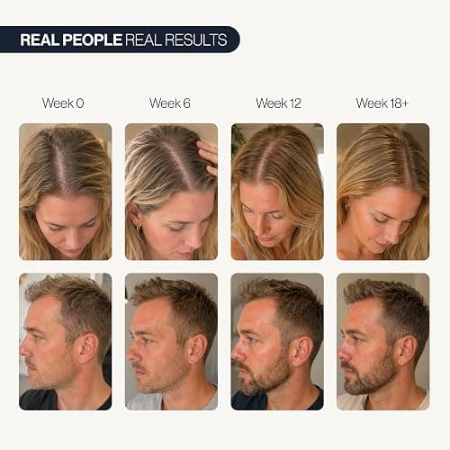 Be Bodywise Hair Growth Serum Roll On - 5% Saw Palmetto, 3% Rosemary Oil for Hair Growth, 3% Fenugreek,1% Caffeine Herbasome | Serum for Hair Loss & Hair Regrowth For Men & Women 25ml/0.84 fl oz thumbnail 5