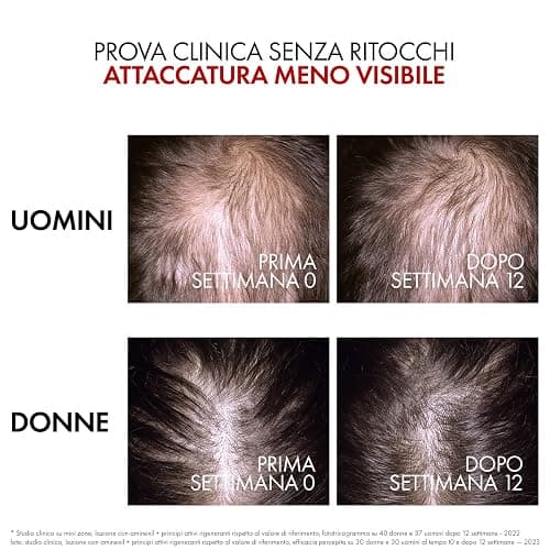 Vichy Dercos Aminexil Clinical R.E.G.E.N. Booster, Siero Rinnovatore Capillare, Per Tutti i Tipi di Cuoio Capelluto, Caduta Temporanea Ridotta, Crescita dei Capelli Esistenti Stimolata, 90 ml thumbnail 6