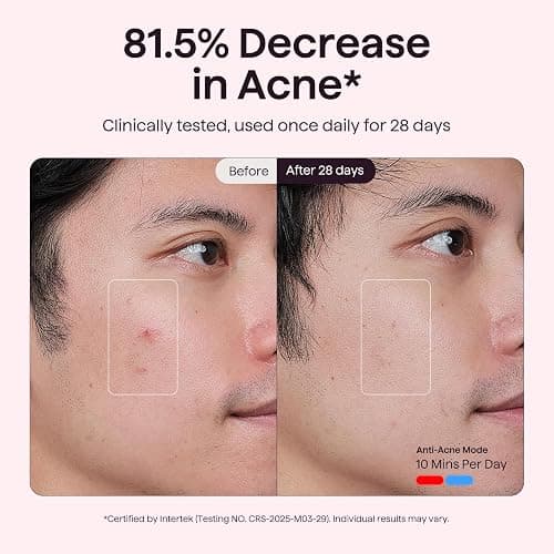 wavytalk Red Light Therapy Mask for Face, Glow Time LED Face Mask Light Therapy for Anti-Fine Line, Acne Treatment and Skin Rejuvenation with Red, Near-Infrared Light, Blue & Amber Light Therapy White thumbnail 4