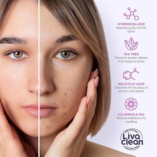 LivaClean 330 Count Pimple Patches for Face with Salicylic Acid, Tea Tree & Calendula Oil – 4 Sizes – Pimple Patches, Hydrocolloid Patch, Acne Patches, Zit Patches, Pimple Stickers thumbnail 5