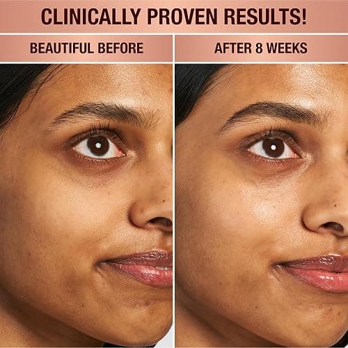 Charlotte Tilbury Magic Eye Rescue - Smoothing & Hydrating Under Eye Cream with Time-Released Retinol & Botanical Complex for Dark Circles, Puffiness & Fine Lines - For Smoother, Youthful Skin thumbnail 3