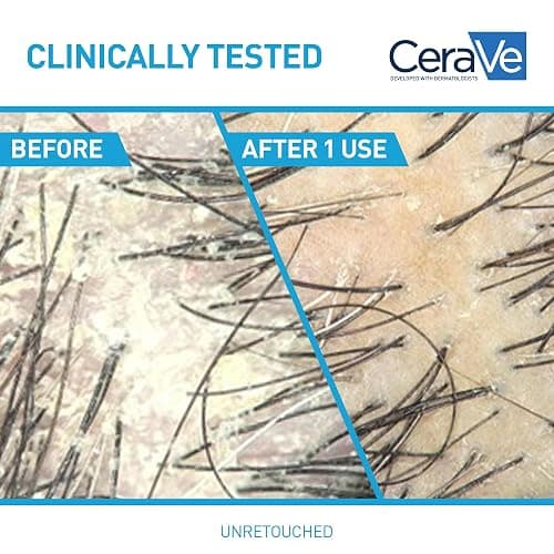 CeraVe Hydrating Anti Dandruff Shampoo, 1% Pyrithione Zinc Dandruff Treatment With Ceramides, Niacinamide & Hyaluronic Acid, Helps Eliminate Flakes & Provides Itchy Scalp Relief, Sulfate Free, 12 Oz thumbnail 4