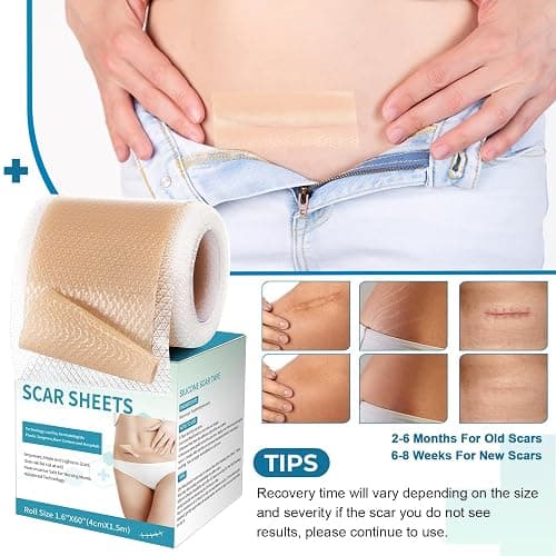 Silicone Scar Sheets, Silicone Scar Tape(1.6”x 60” Roll-1.5M), Silicone Scar Strips, Professional Scar Removal Sheets for Surgical Scars, Keloid, C-Section, Burn et thumbnail 5